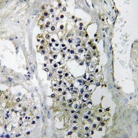 19 - Anti-LIPI Antibody AP60767