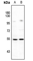 1 - Anti-LIPI Antibody AP60767