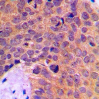 19 - Anti-MINPP1 Antibody AP60768