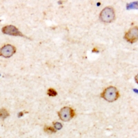 19 - Anti-ME3 Antibody AP60769