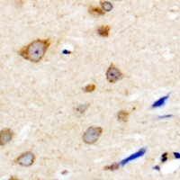 19 - Anti-NBPF5 Antibody AP60770