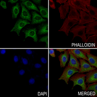 3 - Anti-Prosaposin Antibody AP60775
