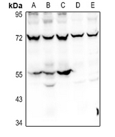 1 - Anti-Prosaposin Antibody AP60775