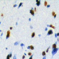 19 - Anti-LUC7L2 Antibody AP60776
