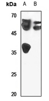 1 - Anti-LUC7L2 Antibody AP60776