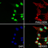 3 - Anti-PPP4R2 Antibody AP60779