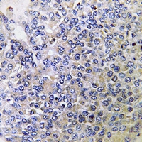 19 - Anti-PPP4R2 Antibody AP60779