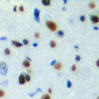 19 - Anti-SESN1 Antibody AP60780