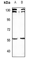 1 - Anti-SESN1 Antibody AP60780