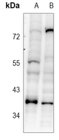 1 - Anti-SRSF8 Antibody AP60782