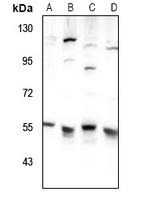 1 - Anti-TIGD3 Antibody AP60785