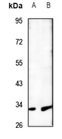 1 - Anti-MTIF3 Antibody AP60786