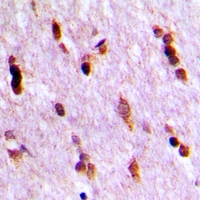 19 - Anti-Ubiquilin 4 Antibody AP60787