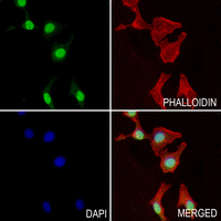3 - Anti-CaMKK beta Antibody AP60789