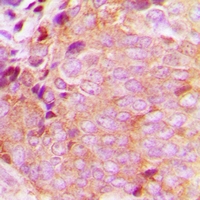 19 - Anti-CaMKK beta Antibody AP60789