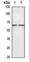 1 - Anti-CaMKK beta Antibody AP60789