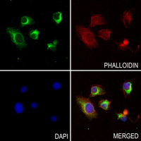 3 - Anti-IGFBP1 Antibody AP60790