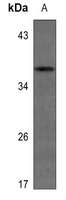 1 - Anti-IGFBP1 Antibody AP60790