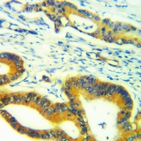 19 - Anti-DPD Antibody AP60792