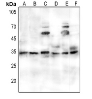 1 - Anti-PORIN Antibody AP60793