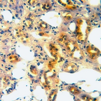 19 - Anti-CD316 Antibody AP60796