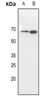 1 - Anti-CD316 Antibody AP60796