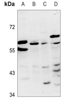 1 - Anti-ZNF384 Antibody AP60797
