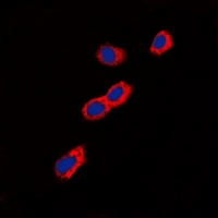 3 - Anti-GIP Receptor Antibody AP60804