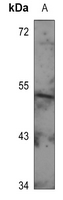 1 - Anti-GIP Receptor Antibody AP60804