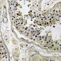19 - Anti-Inhibin beta C Antibody AP60806