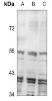 1 - Anti-Inhibin beta C Antibody AP60806