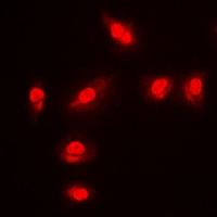 3 - Anti-FOXO1 (Phospho-S256) Antibody AP60808