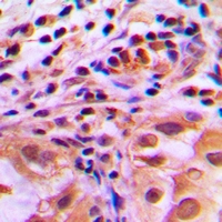 19 - Anti-FOXO1 (Phospho-S256) Antibody AP60808