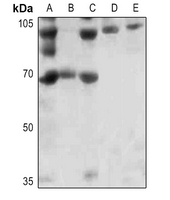 1 - Anti-FOXO1 (Phospho-S256) Antibody AP60808