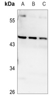 1 - Anti-VPS4B Antibody AP60809