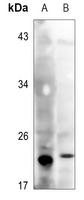 1 - Anti-Glutathione Peroxidase Antibody AP60810