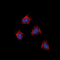 3 - Anti-AT1 Antibody AP60812