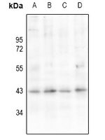 1 - Anti-AT1 Antibody AP60812