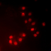 3 - Anti-MKI67IP (Phospho-T234) Antibody AP60813