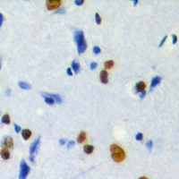 19 - Anti-MKI67IP (Phospho-T234) Antibody AP60813