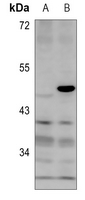 1 - Anti-MKI67IP (Phospho-T234) Antibody AP60813