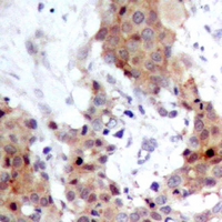 19 - Anti-FOXO1/3 Antibody AP60814