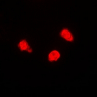 3 - Anti-TIP60 Antibody AP60815