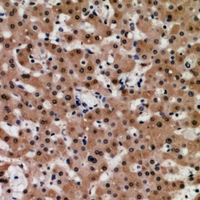 19 - Anti-TIP60 Antibody AP60815