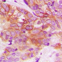 19 - Anti-AXL Antibody AP60816