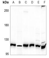 1 - Anti-AXL Antibody AP60816