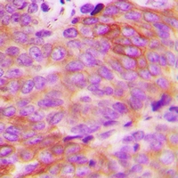 19 - Anti-Alpha-1D Adrenergic Receptor Antibody AP60817