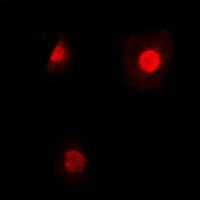 3 - Anti-TEAD2 Antibody AP60818