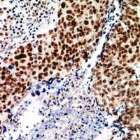 19 - Anti-TEAD2 Antibody AP60818
