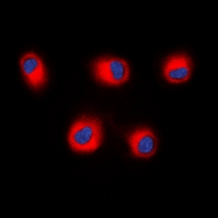 3 - Anti-STEAP2 Antibody AP60819